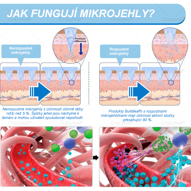FDA Store |𝐵uil𝗱𝐿ea𝐟® 𝑮𝐋𝑃-1 zeštíhlující a zpevňující nanojehličková náplast s kolagenem, kurkumou a Matrixylem 3000 │ Obezita, kardiovaskulární onemocnění, cukrovka, spánková apnoe, problémy s klouby a další